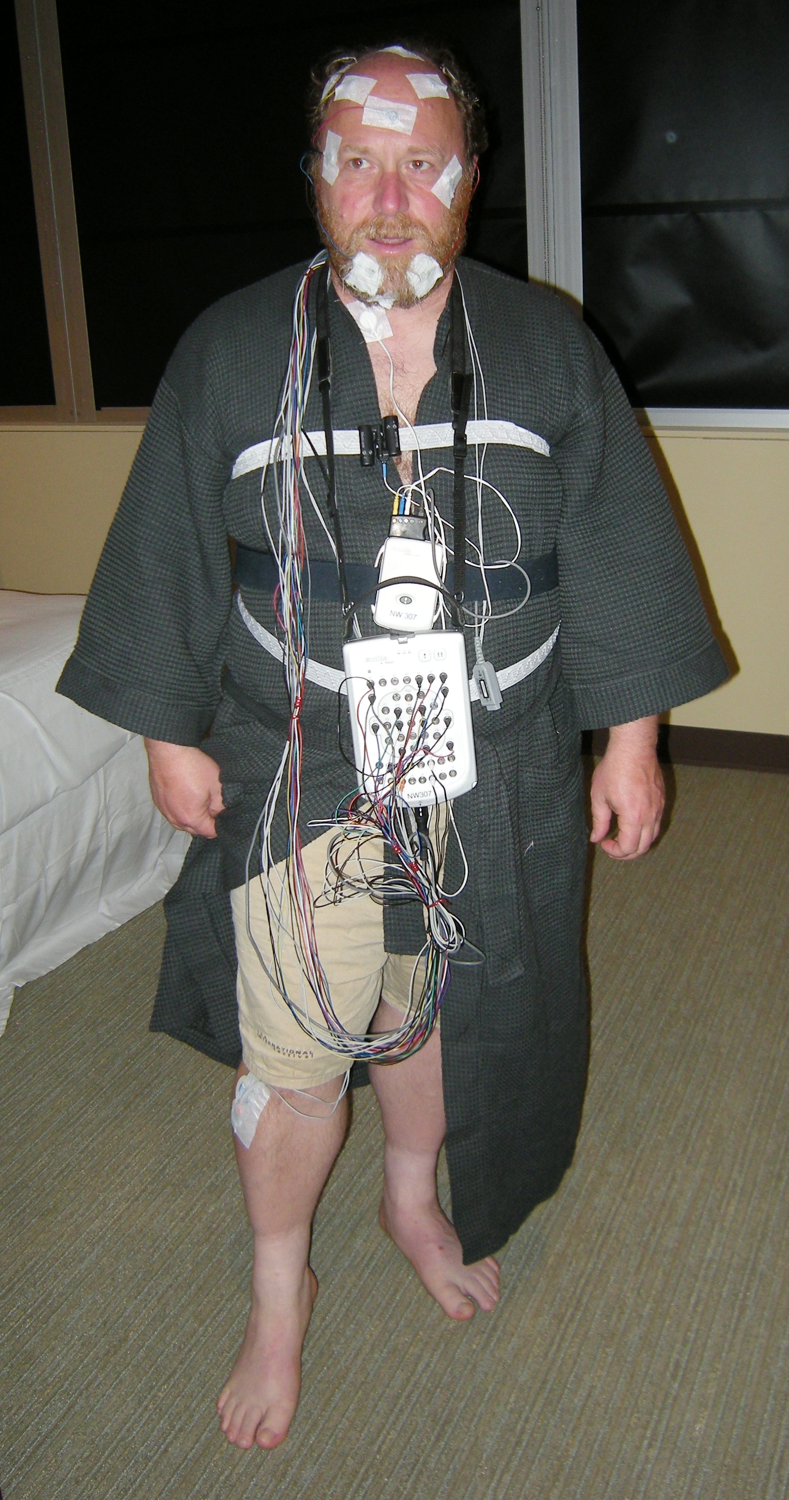 A person wired up for a sleep study with electrodes and sensors, illustrating the clinical recordings that power the new AI model